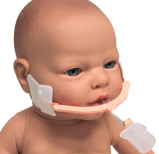 NeoBar - Fixador tubo orotraqueal