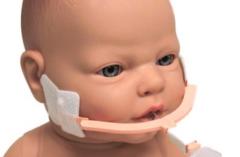 NeoBar - Fixador tubo orotraqueal